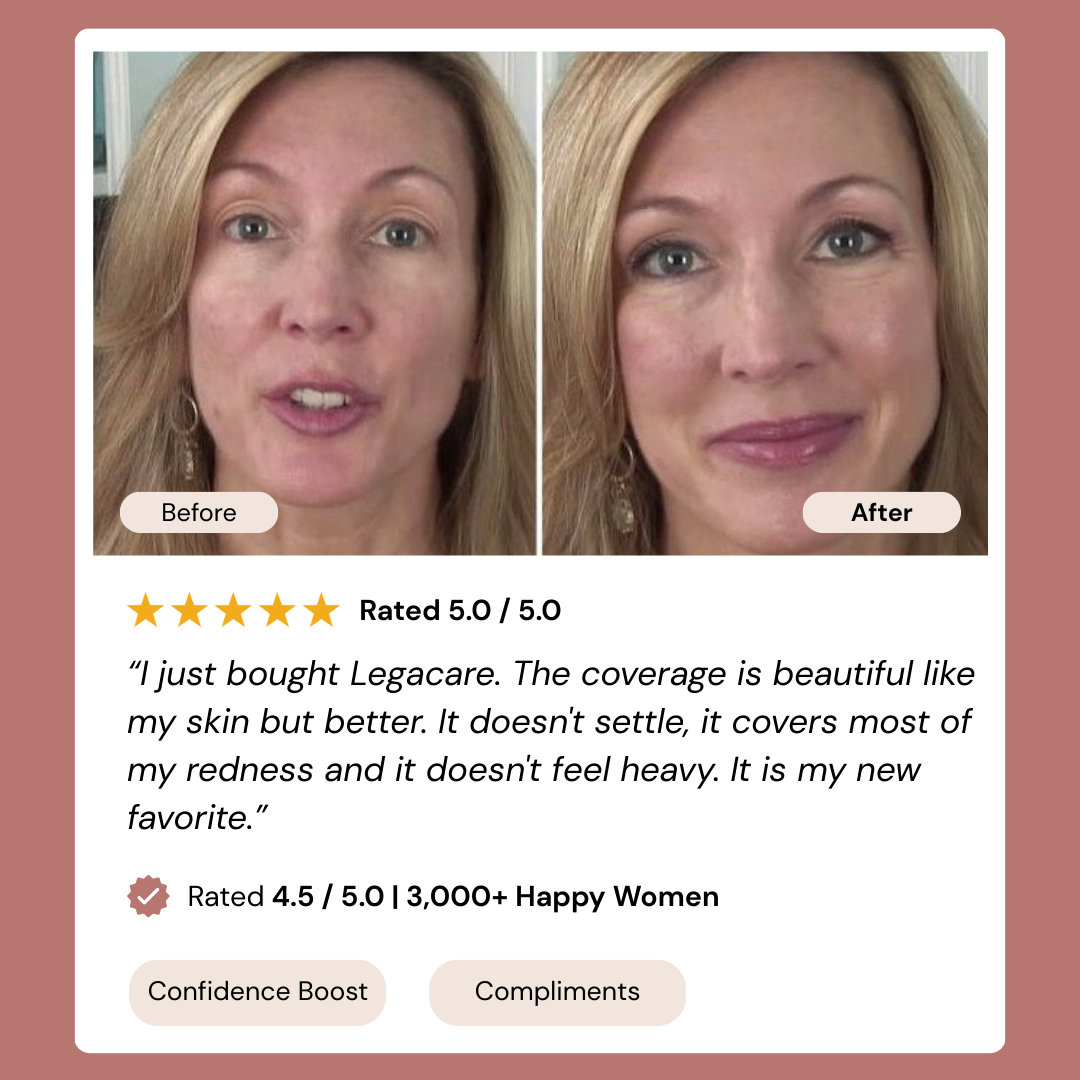 Legacare Anti Age Kit (2 Bottles + Free gifts) champ