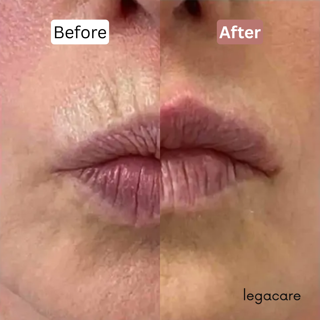 Anti-Aging Multi Balm